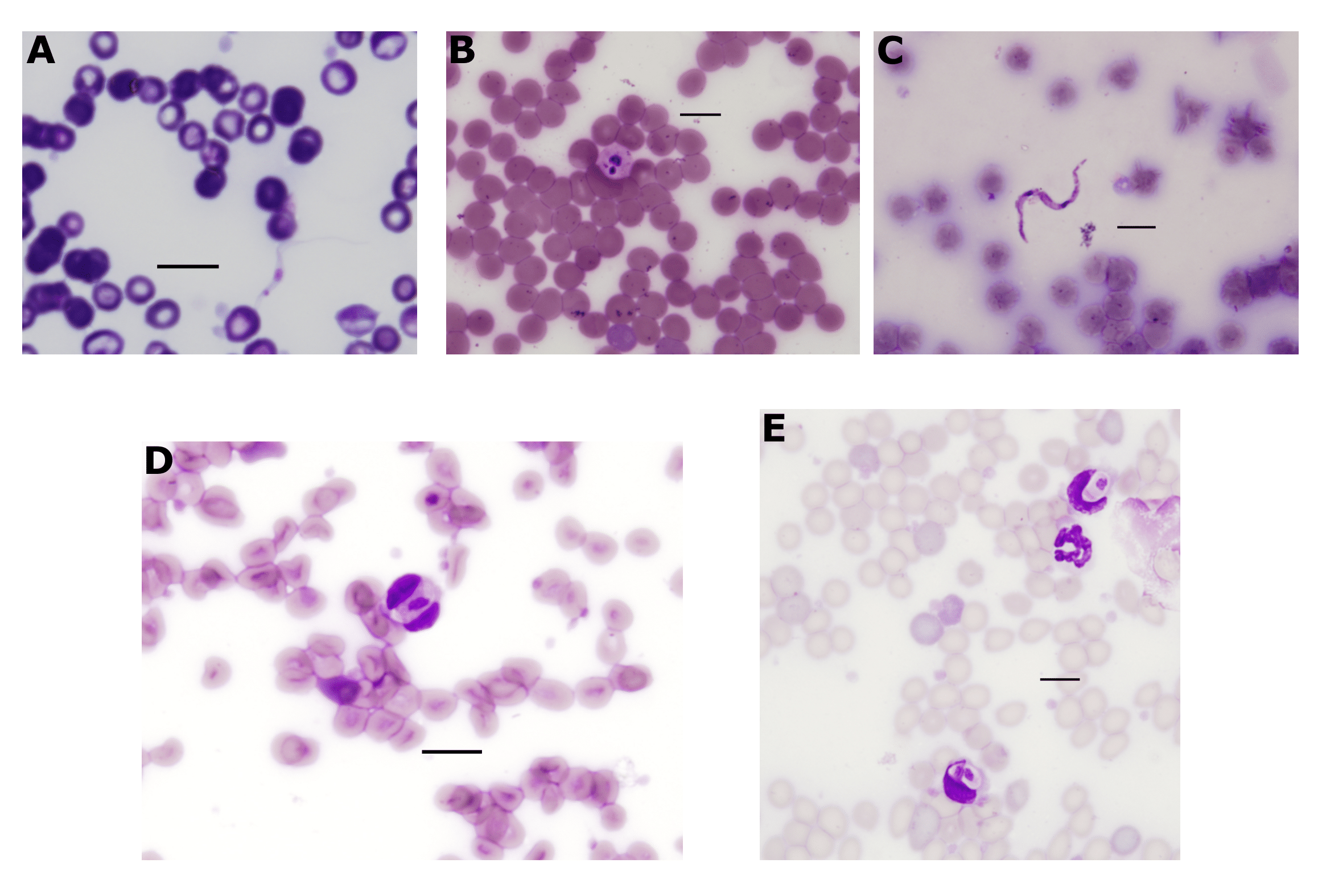 Haemoprotozoa identified in wildlife blood films. (A) Trypomastigote of \textit{Trypanosoma gilletti} from long-nosed bandicoot (LNB113). (B) Suspected amastigote of \textit{Trypanosoma cyclops} from black rat (BR022). (C) Trypomastigote of \textit{Trypanosoma cyclops} from black rat (BR025). (D-E) \textit{Hepatozoon} gametocytes within leukocytes of a black rat (BR039). All scale-bars: 10 $\mu$M.